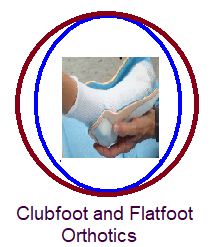Clubfoot & Flatfoot